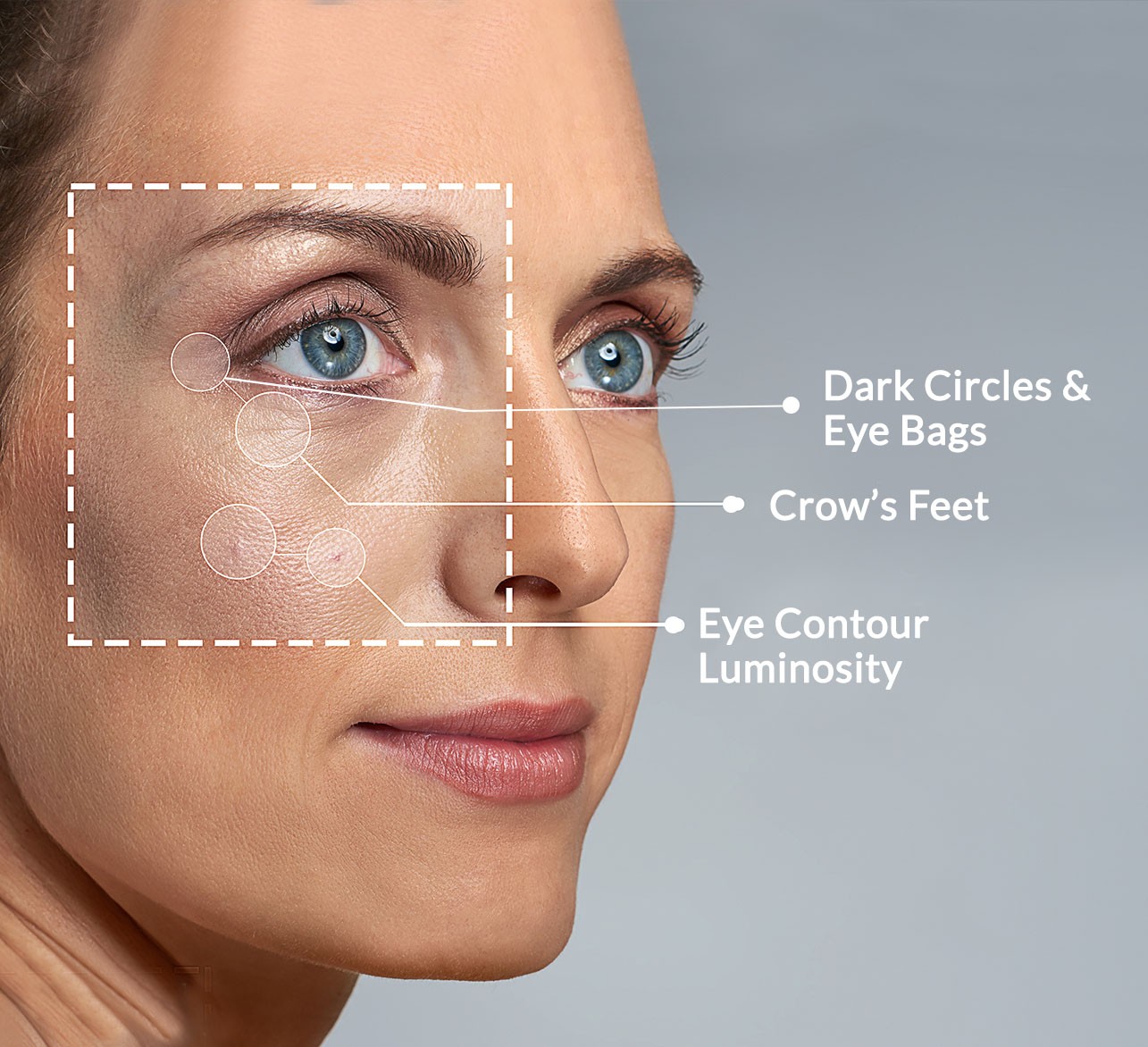 Highlighted eye area with crow's feet, dark circles and eye bags and eye contour luminoosity