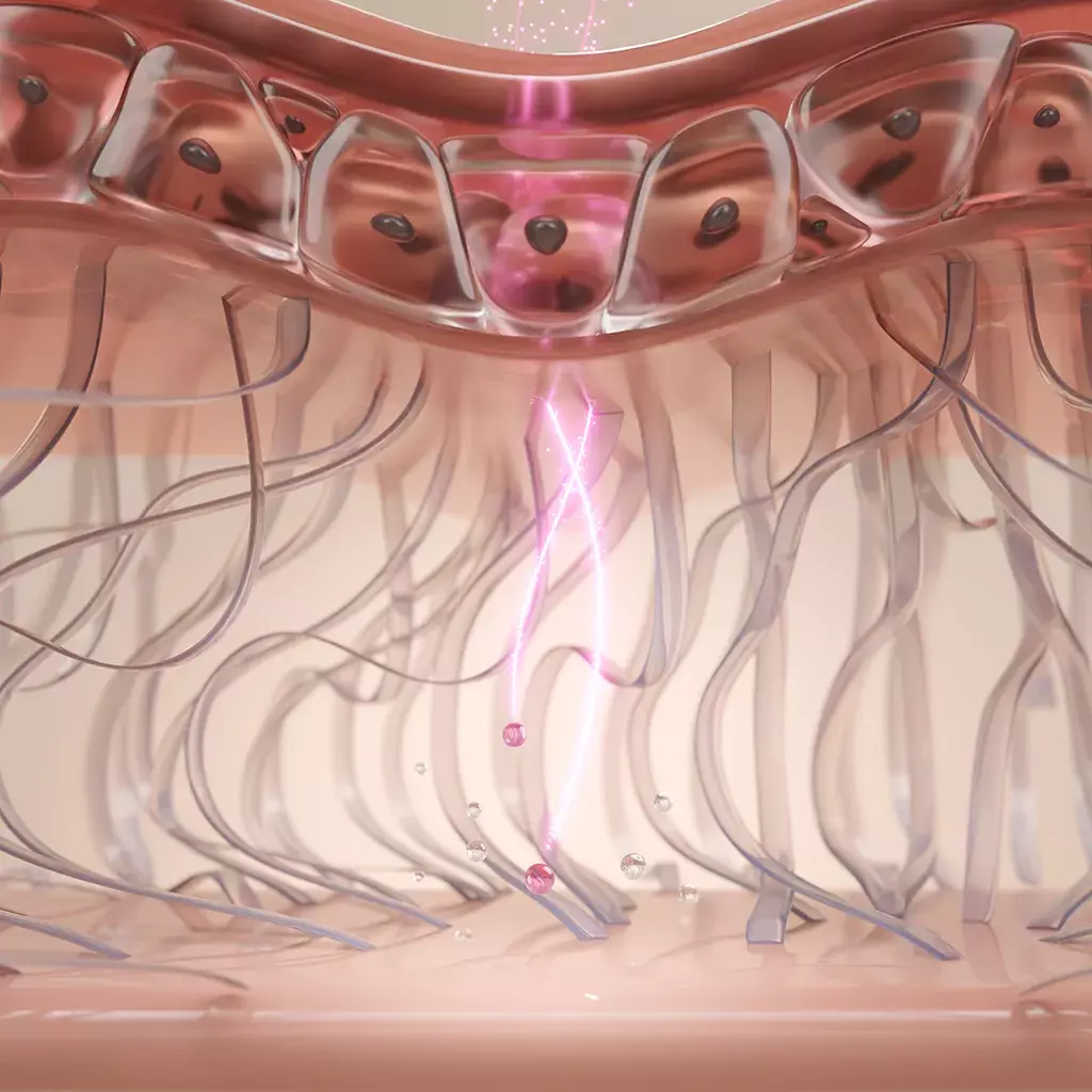 Breaking of elastin under skin