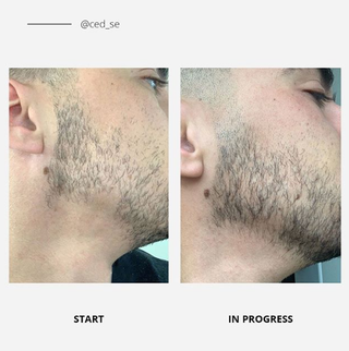 Natural Beard Oil | Beard Growth Kit | Beard Care | CGrooming | Beard Growth Oil | Organic Beard Oil | Beard Kit