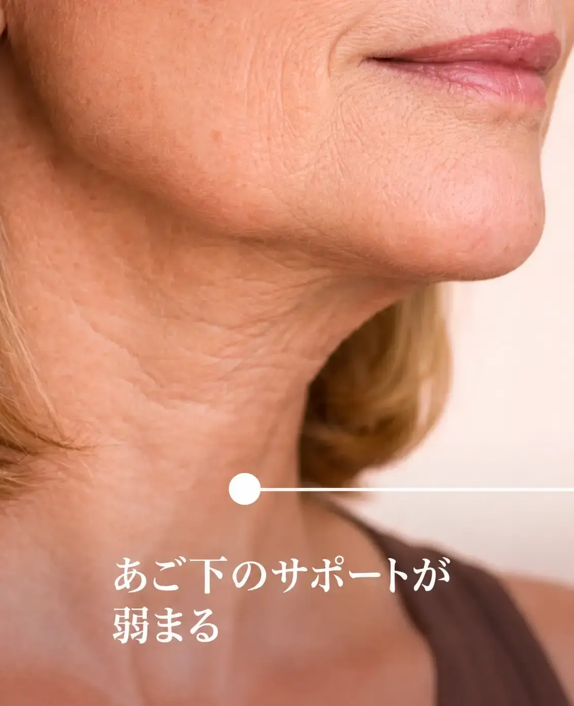 Women showing Under-chin support weakens