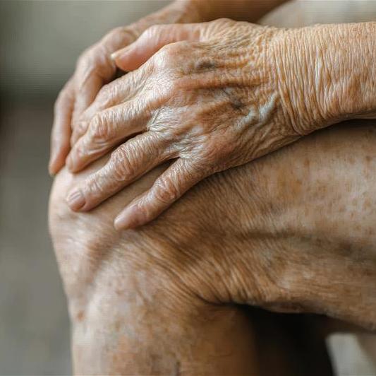 wrinkled skin