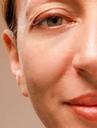 woman face showing reduction in wrinkles and fine lines 