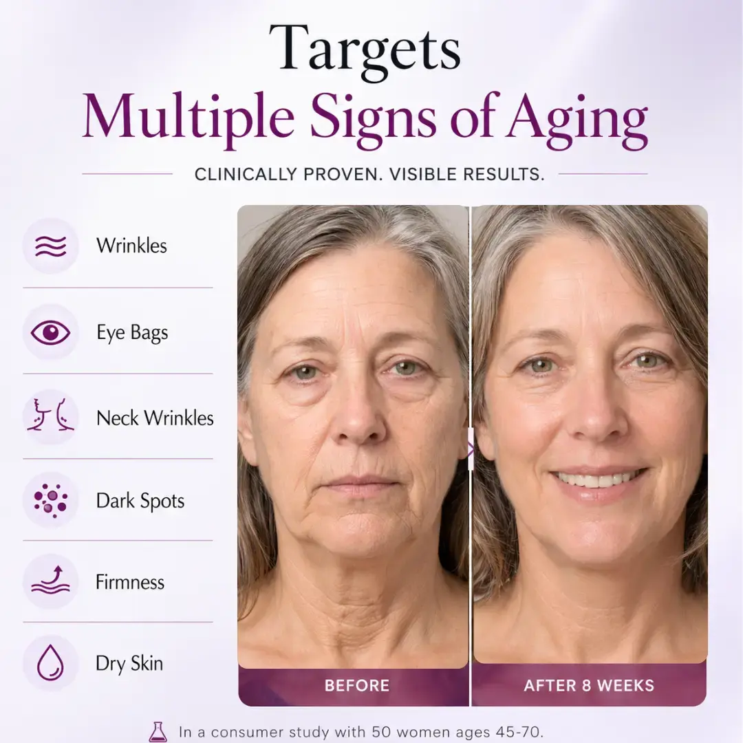 Strateva RX all in one anti aging serum targets wrinkles, dark spots, dark circles, fine lines, eye bags