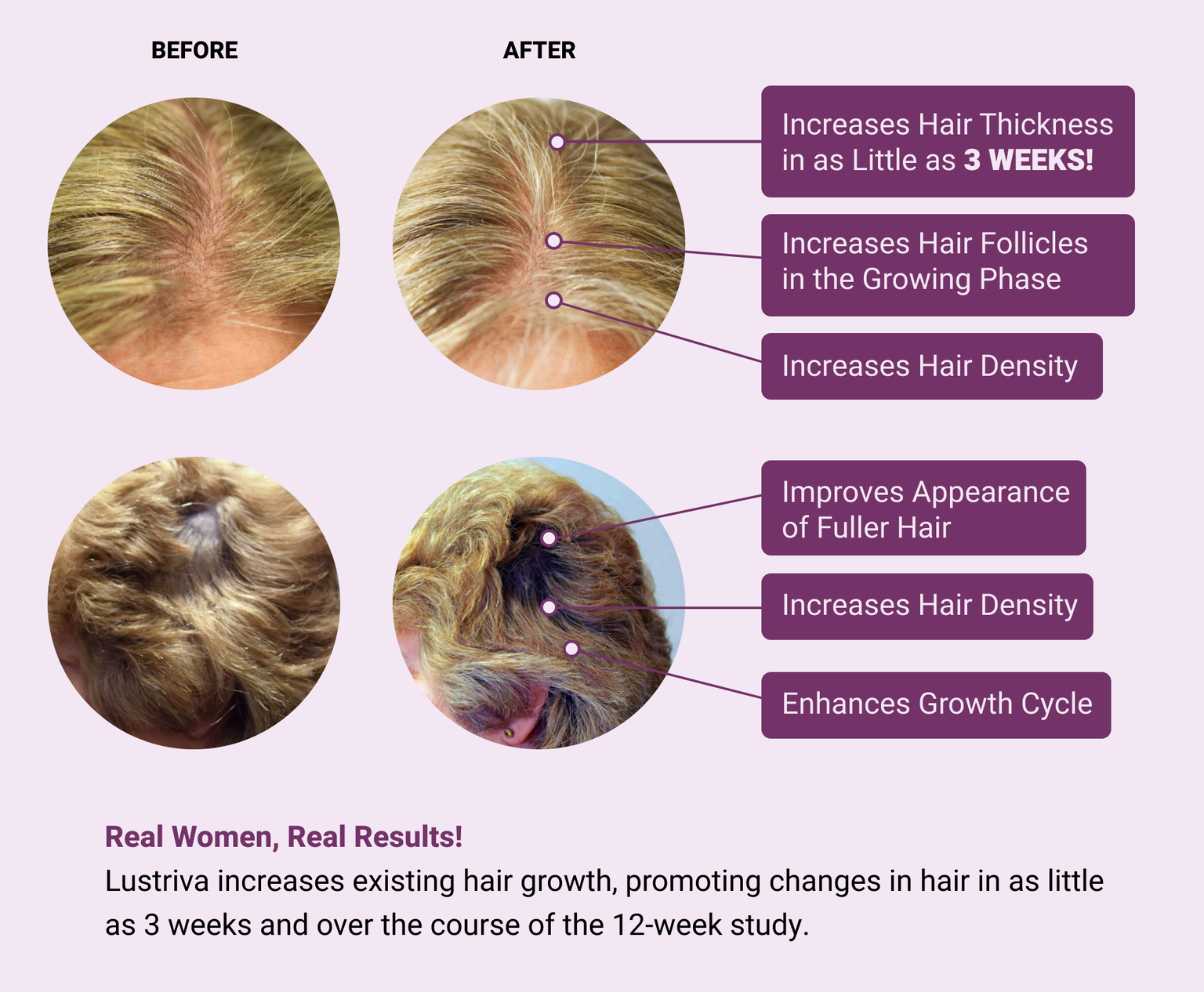 Hair Growth Accelerator