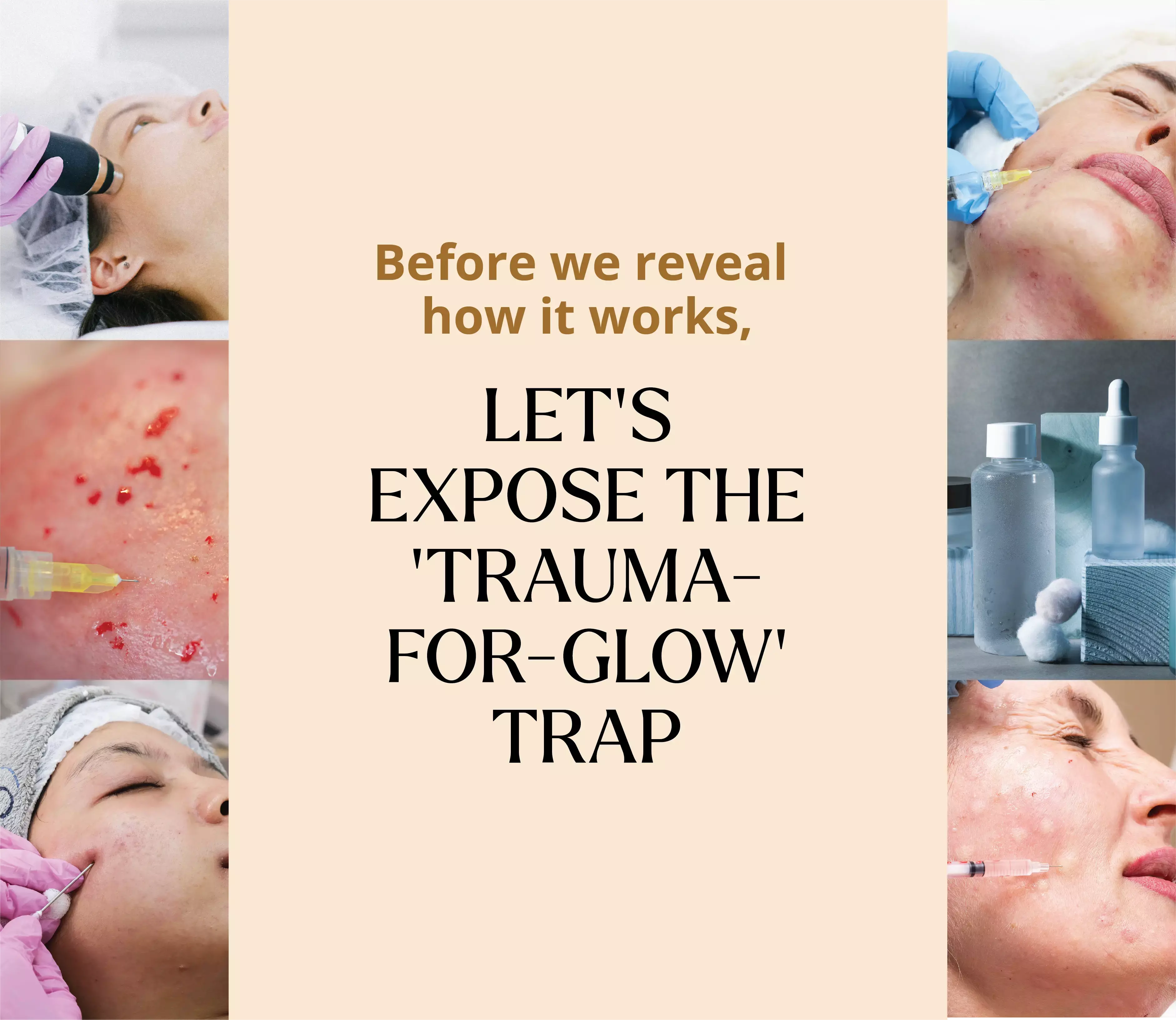 Peels. Acids. High-strength "pro" serums. Microneedling. $300 clinical facials