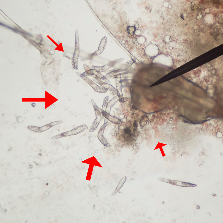 5 Best Natural Demodex Remedies To Get Rid Of Eyelash Mites And Bugs