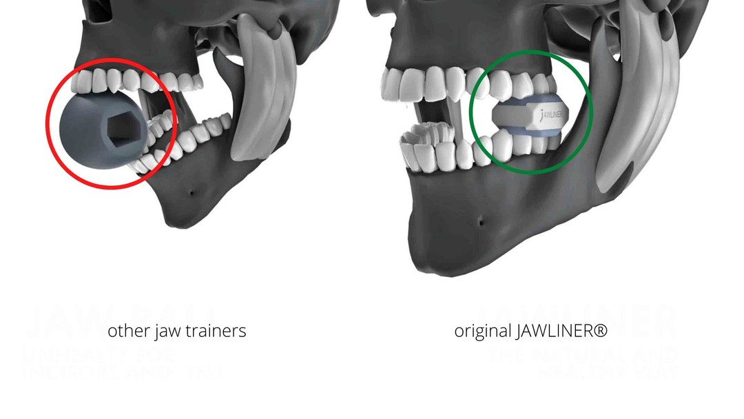 Jaw Exerciser Muscler Machoire Gomme Machoire Musculation Jaw Train
