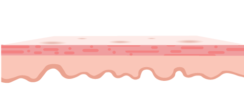 image of first layer of skin - epidermis