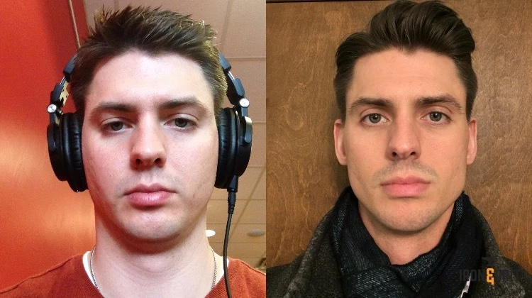 Before&after jawline training
