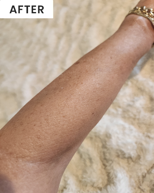 After image of customer 2