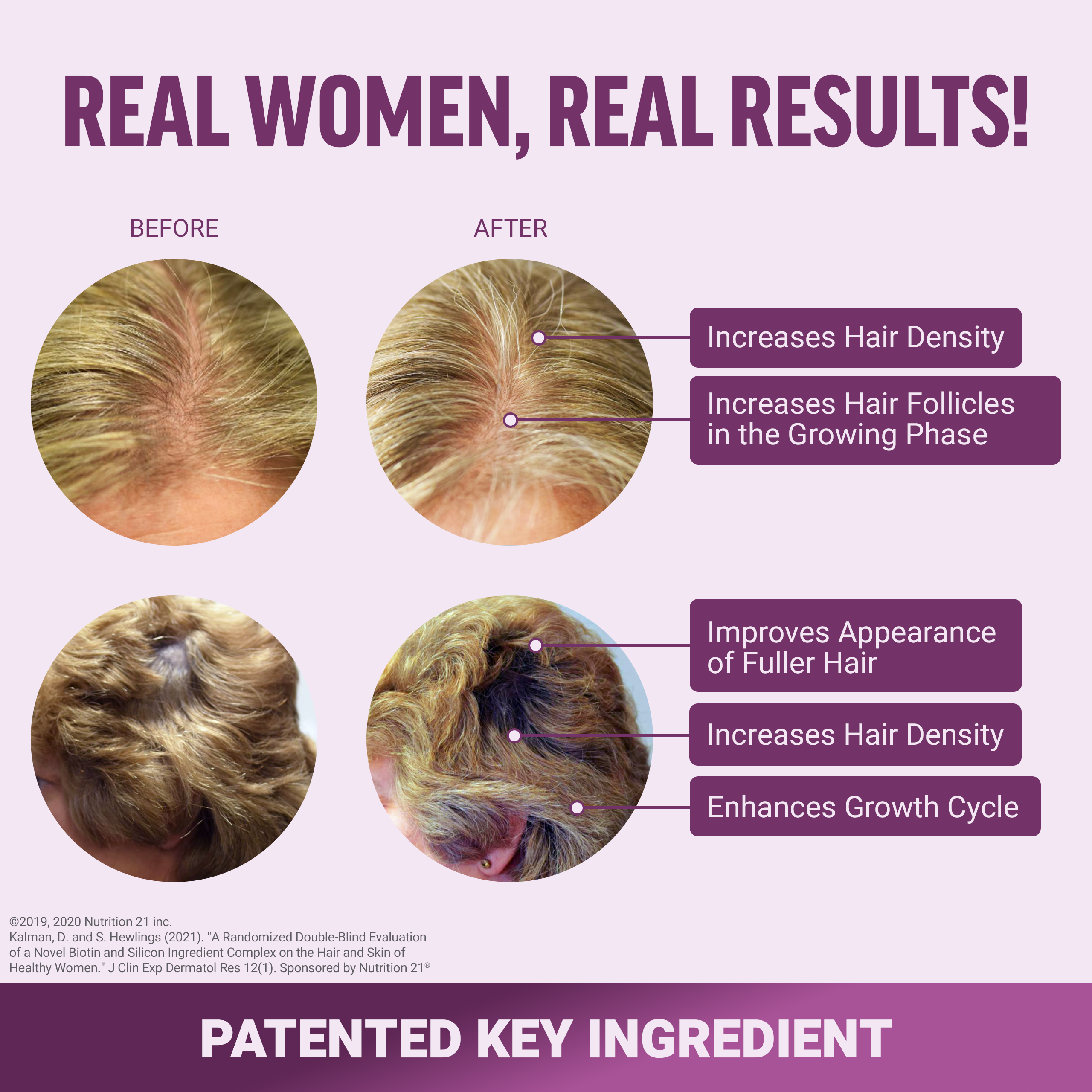 Real Women, Real Results! hair growth vitamins, hair growth supplement, lustriva