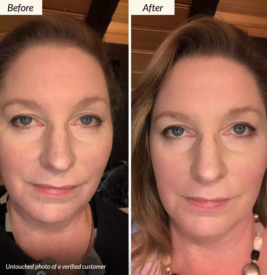 Before and After using Kesaradi Oil 2