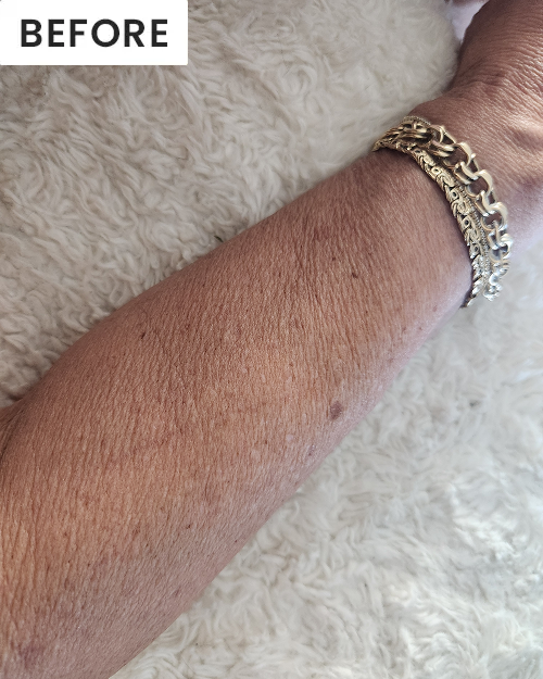 After image of customer 2