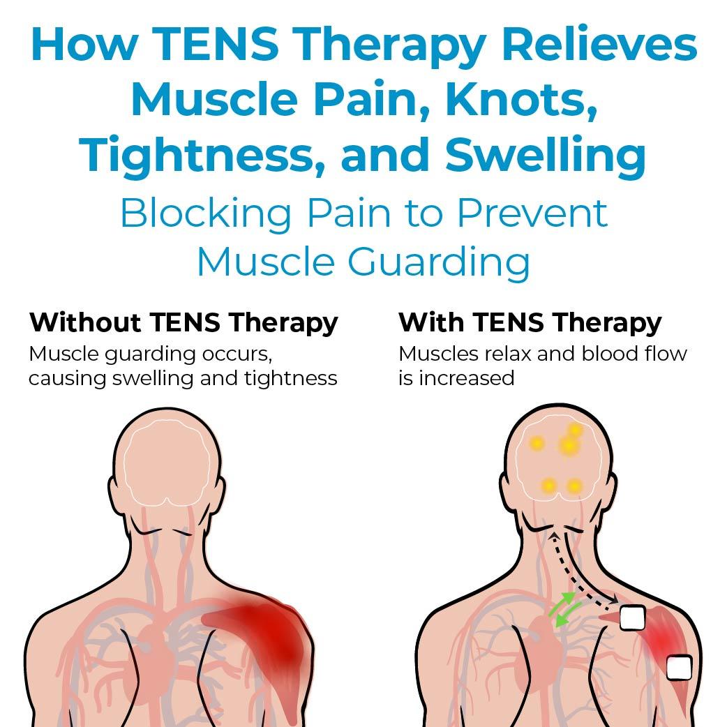 Who Is a Candidate for TENS Therapy?