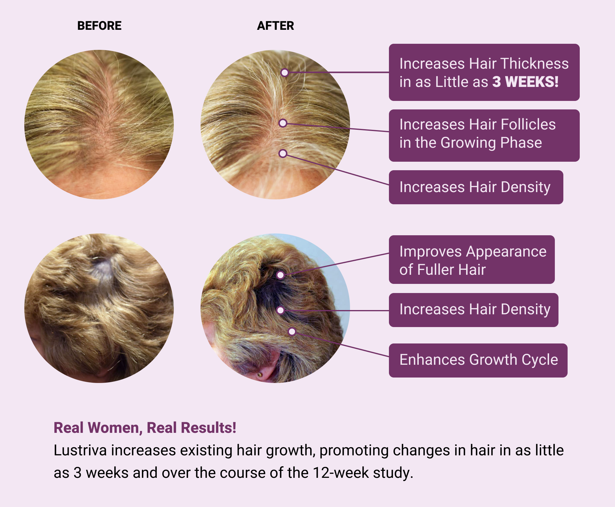 before and after photos of subject results from the study using lustriva