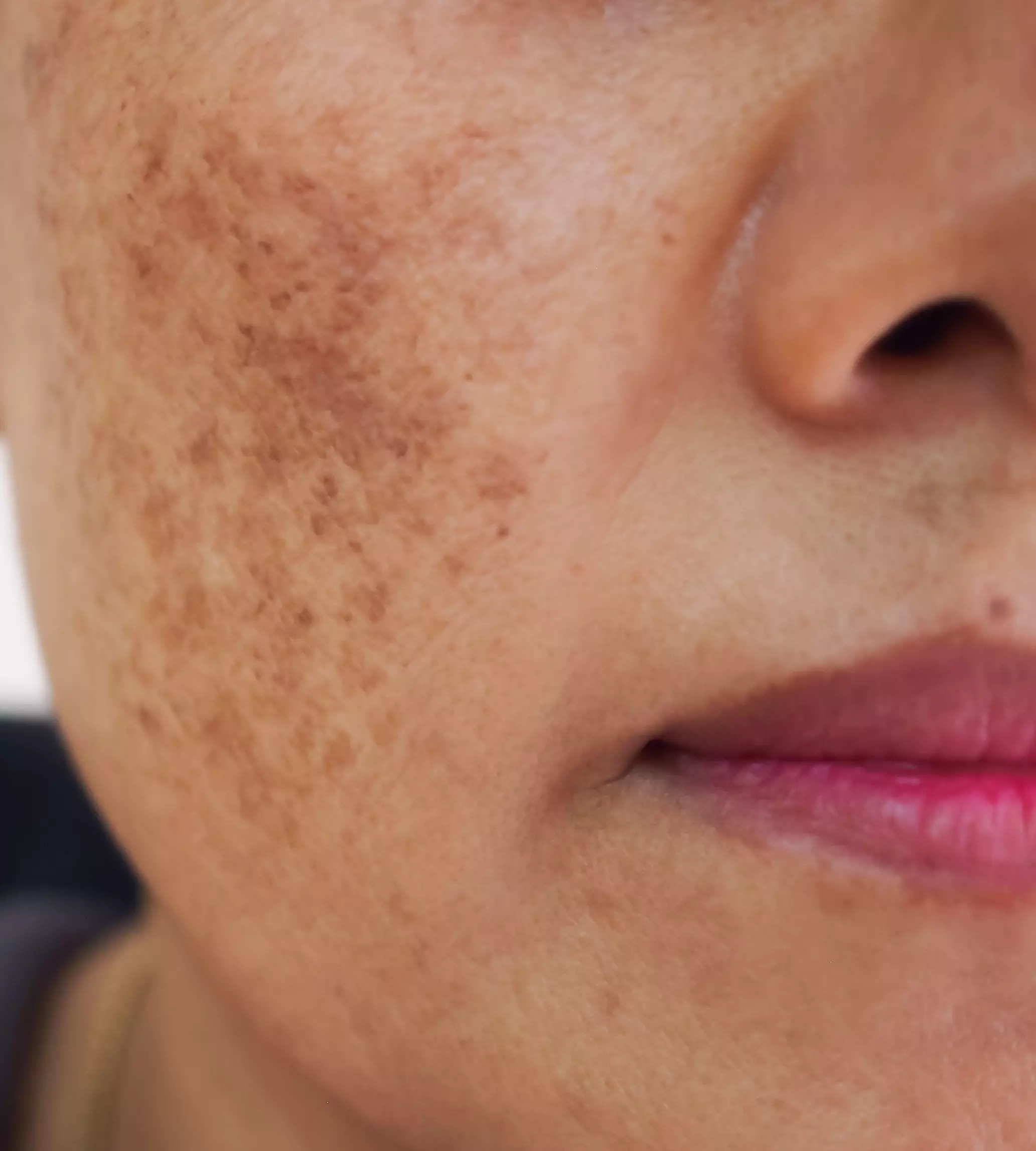 Textured skin