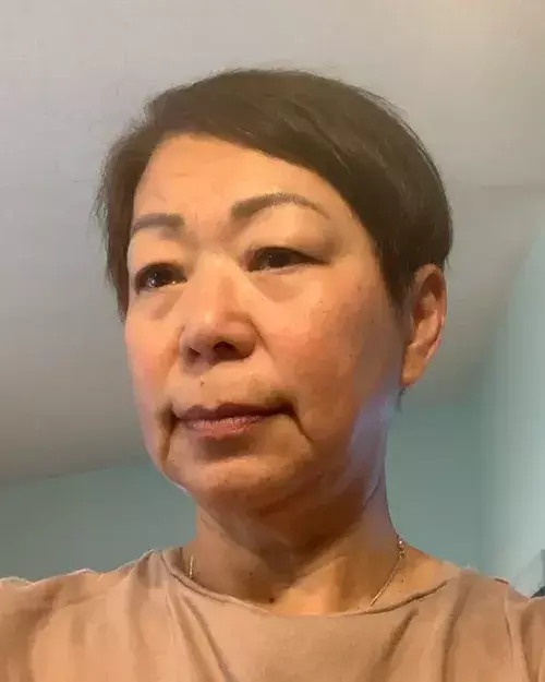 After image of customer 3