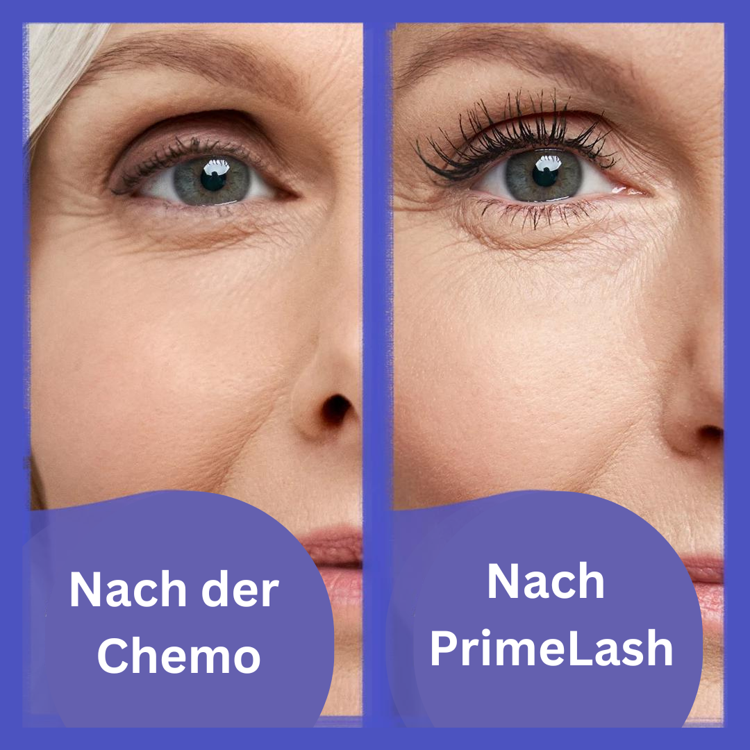 Nachmalen Ihrer Augenbrauen während Chemotherapie - Oncovia