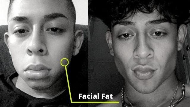 how to get a chiseled jaw