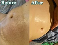 Customer review showing skin texture improvement before and after using Bella Terra skincare products, with visibly refined pores and smoother skin after treatment