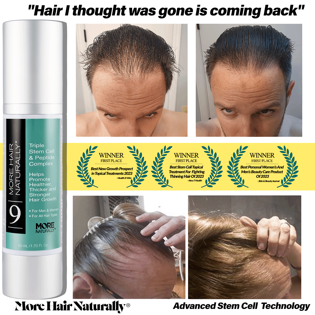 Awards and hair growth photos