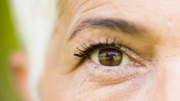 What causes wrinkles and remedies for getting rid of wrinkles
