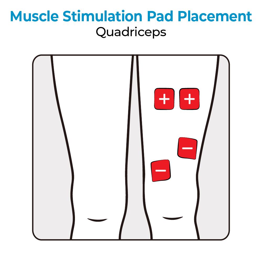 A diagram showing muscle stim pad placement for quadriceps. Text, "Muscle Stimulation Pad Placement: Quadriceps"