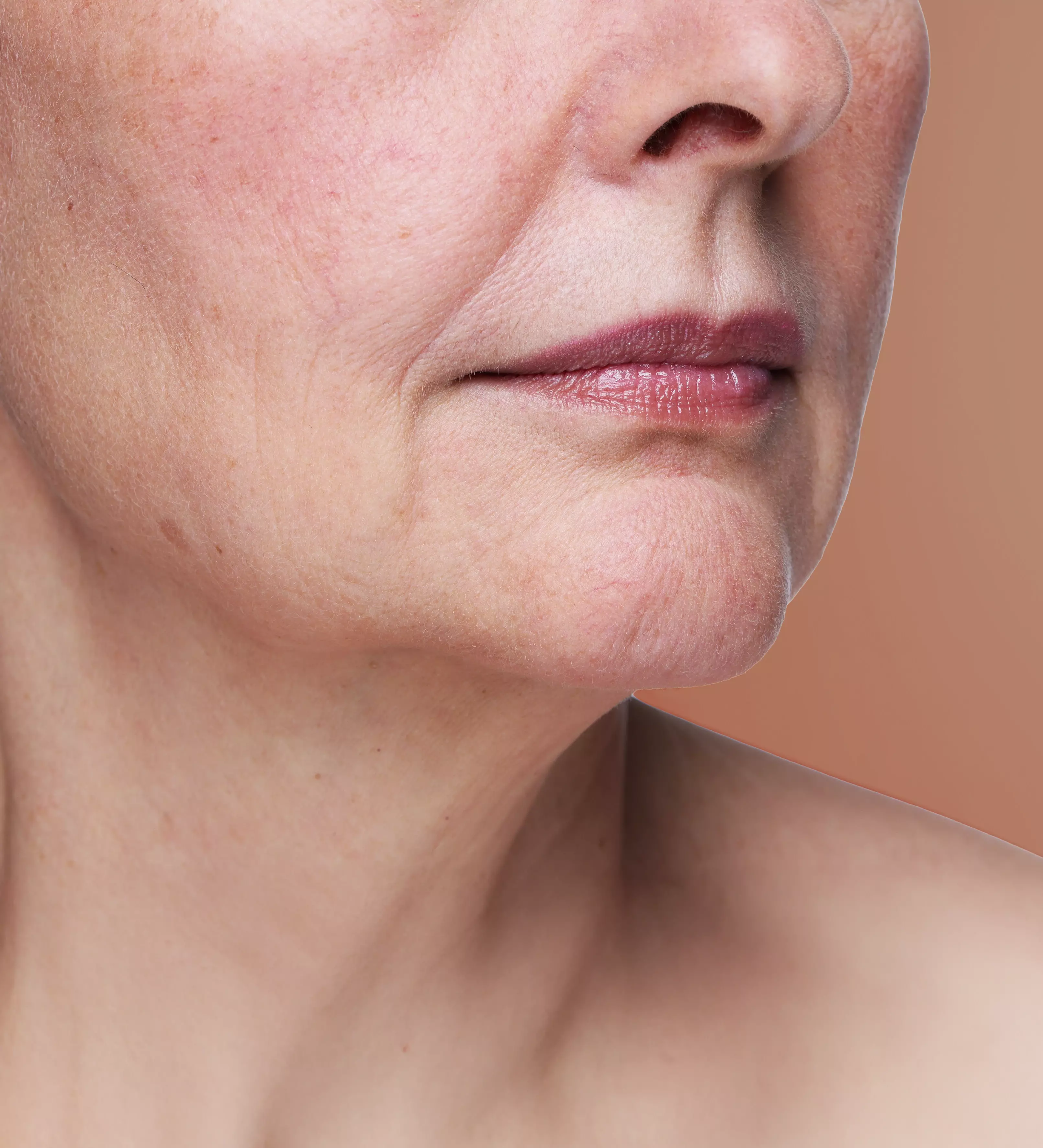 Less defined jawline, dry, fragile skin texture