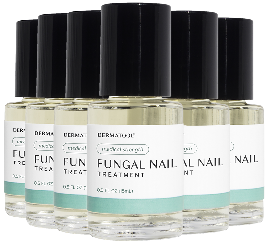 Nail Fungus Treatment - 6 Bottle Bundle