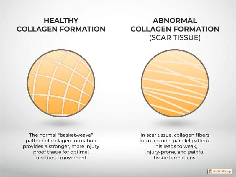 collagen and injury recovery