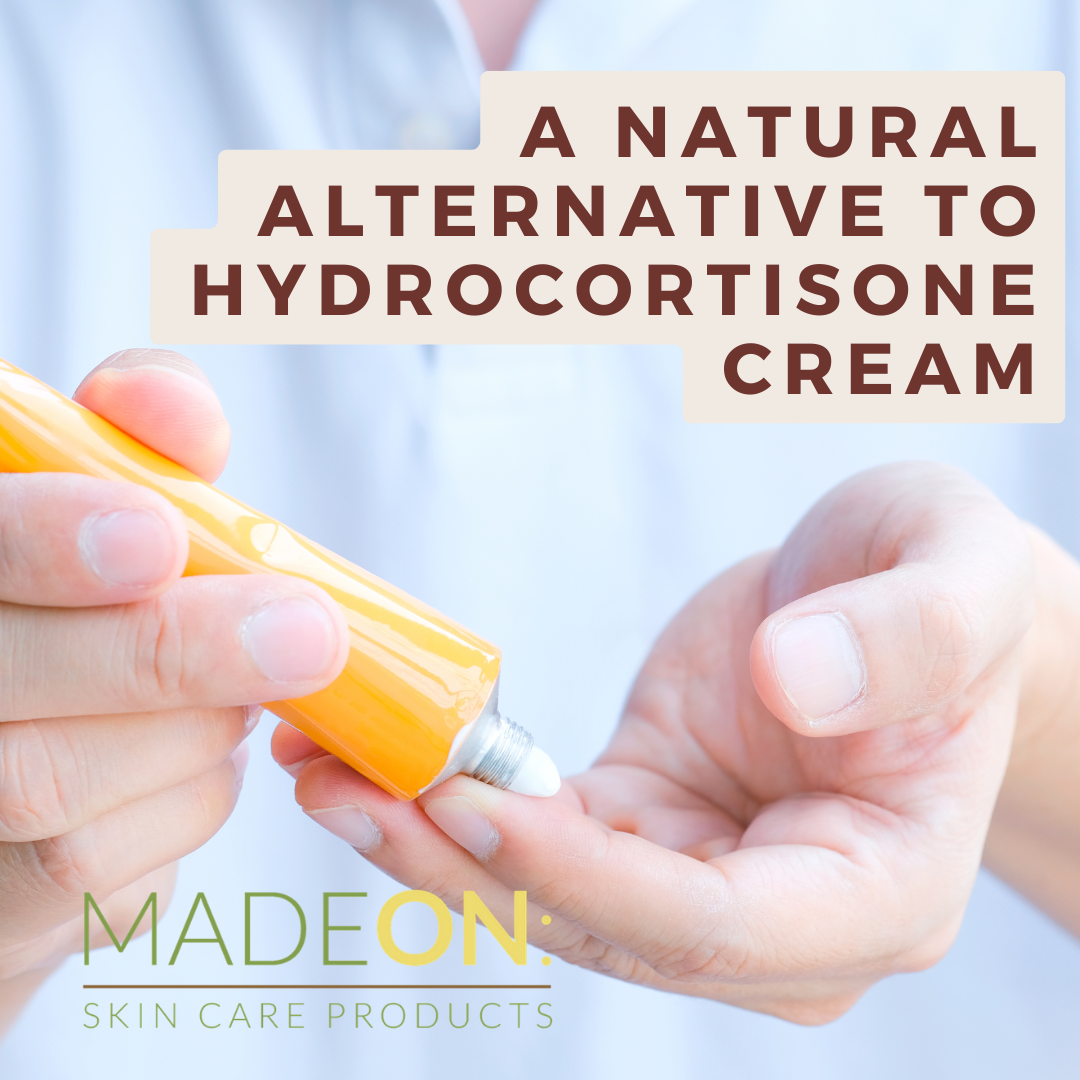 hands squeezing hydrocortisone cream out of a tube