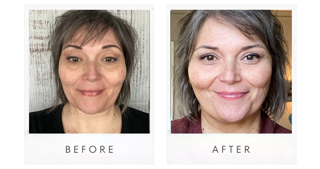 Before and After results of using Yauvari