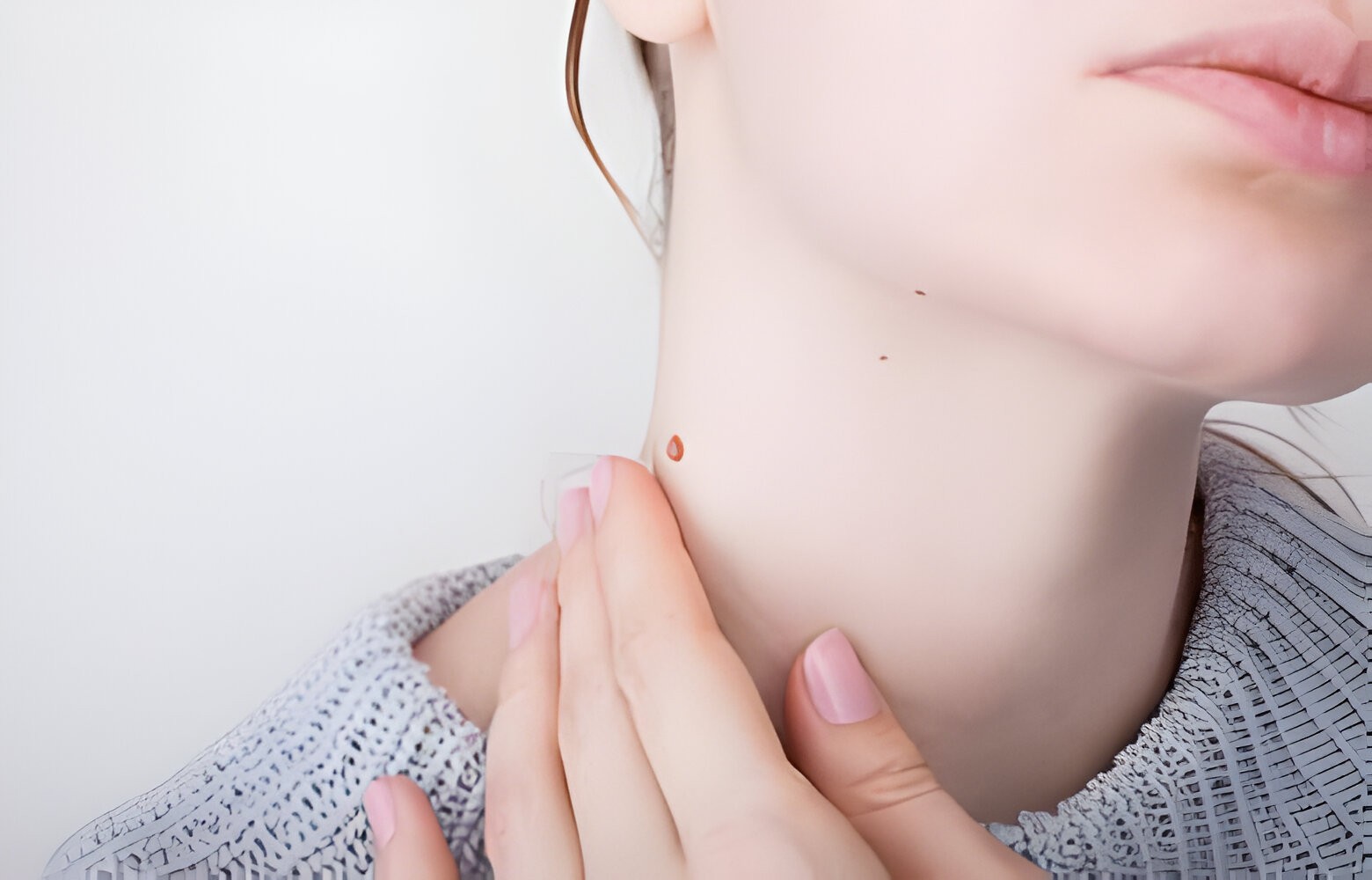 Best Essential Oils for Warts Removal