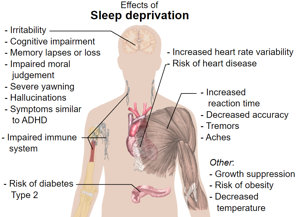 sleep deprivation