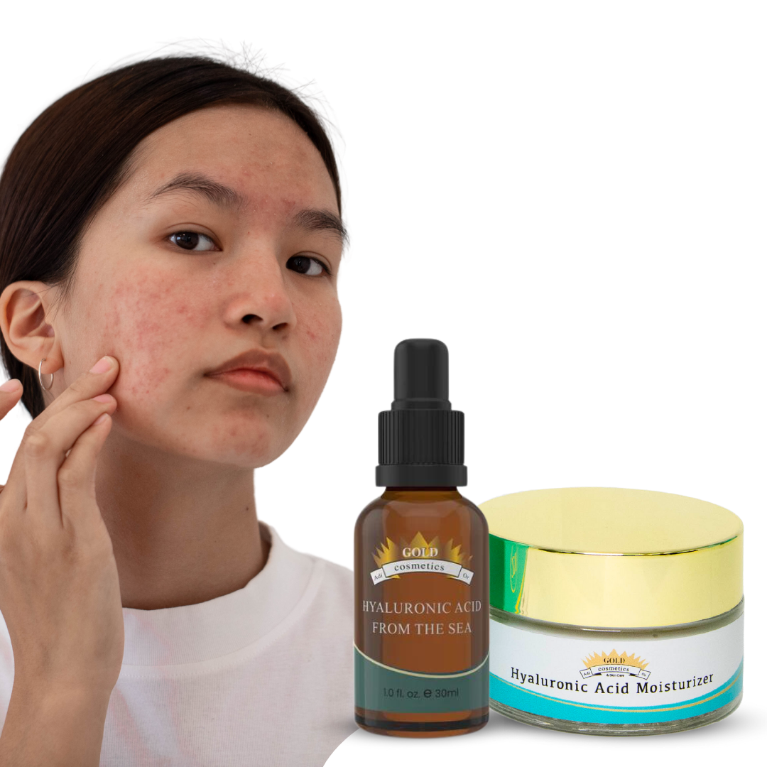 Is Hyaluronic Acid Advisable for AcneProne Skin?