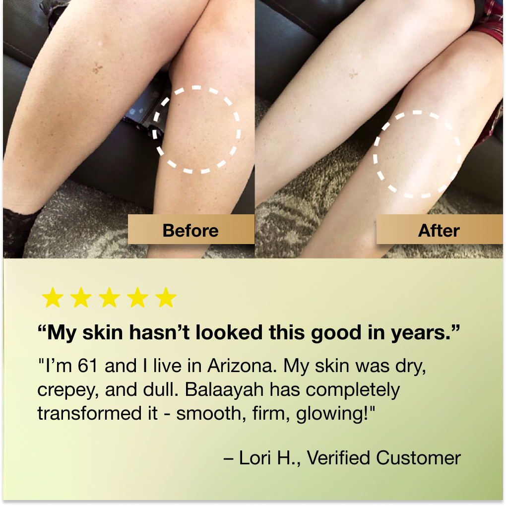 Balaayah Black Gram 5 star testimonial
