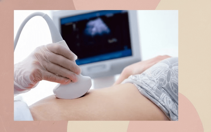 La grossesse extra-utérine