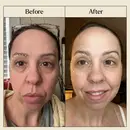 Before/after