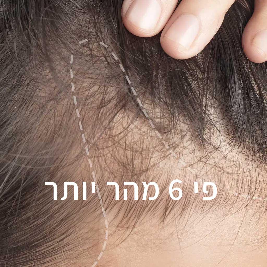 Scalp aging