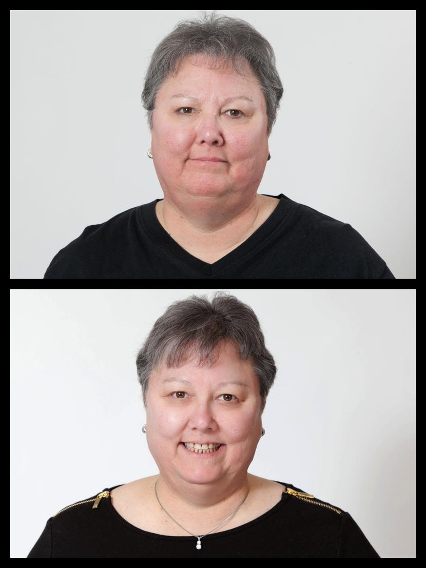 Bone Broth Diet and Benefits | Weight Loss Plan | Dr. Kellyann