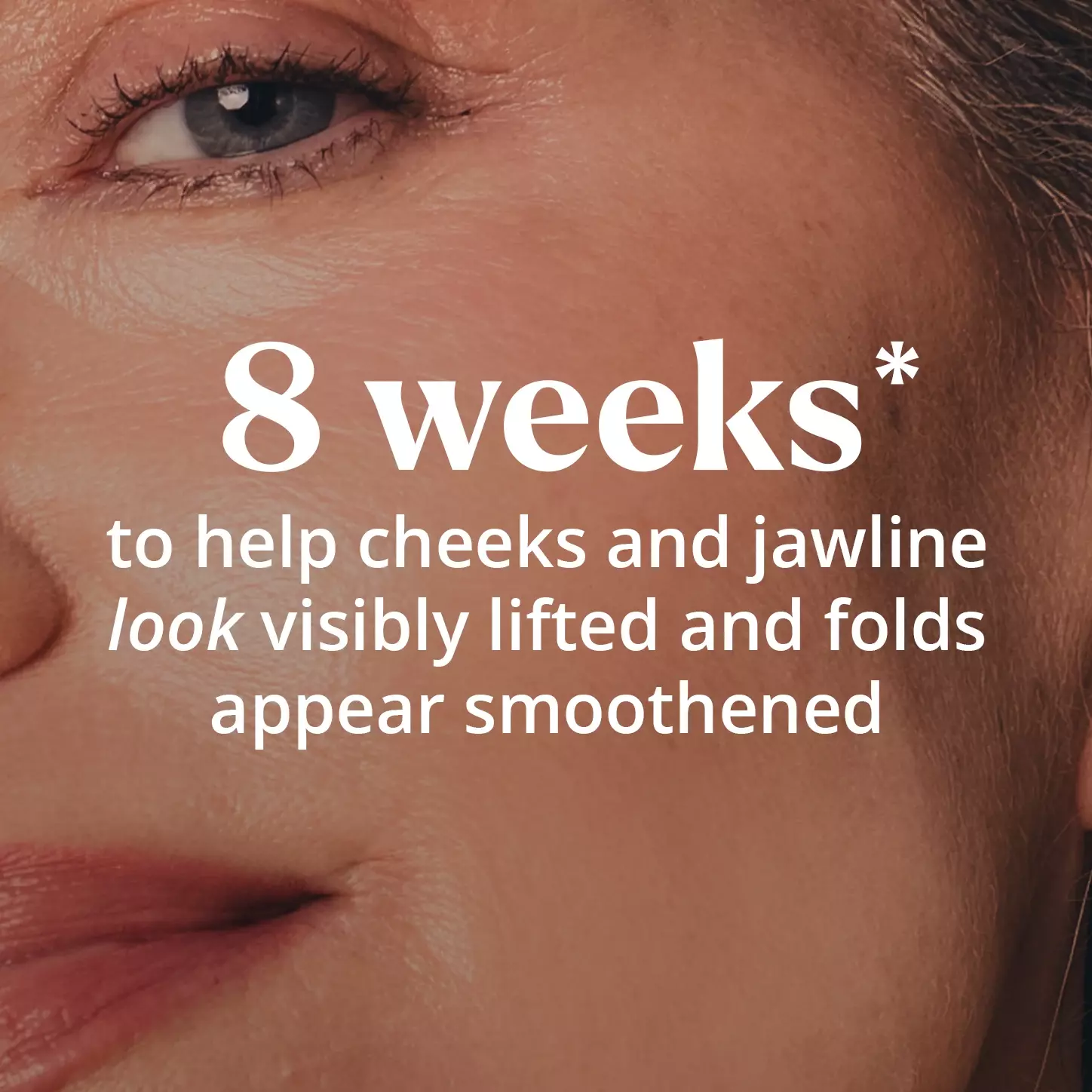 8 weeks* to help cheeks and jawline look visibly lifted and folds appear smoothened