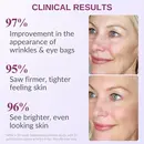 Strateva RX clinical results- 96% improvement in appearance of wrinkles, 95% showed brighter looking skin
