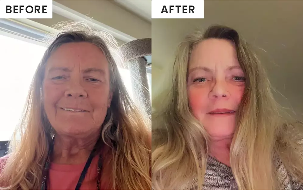 after of customer 1