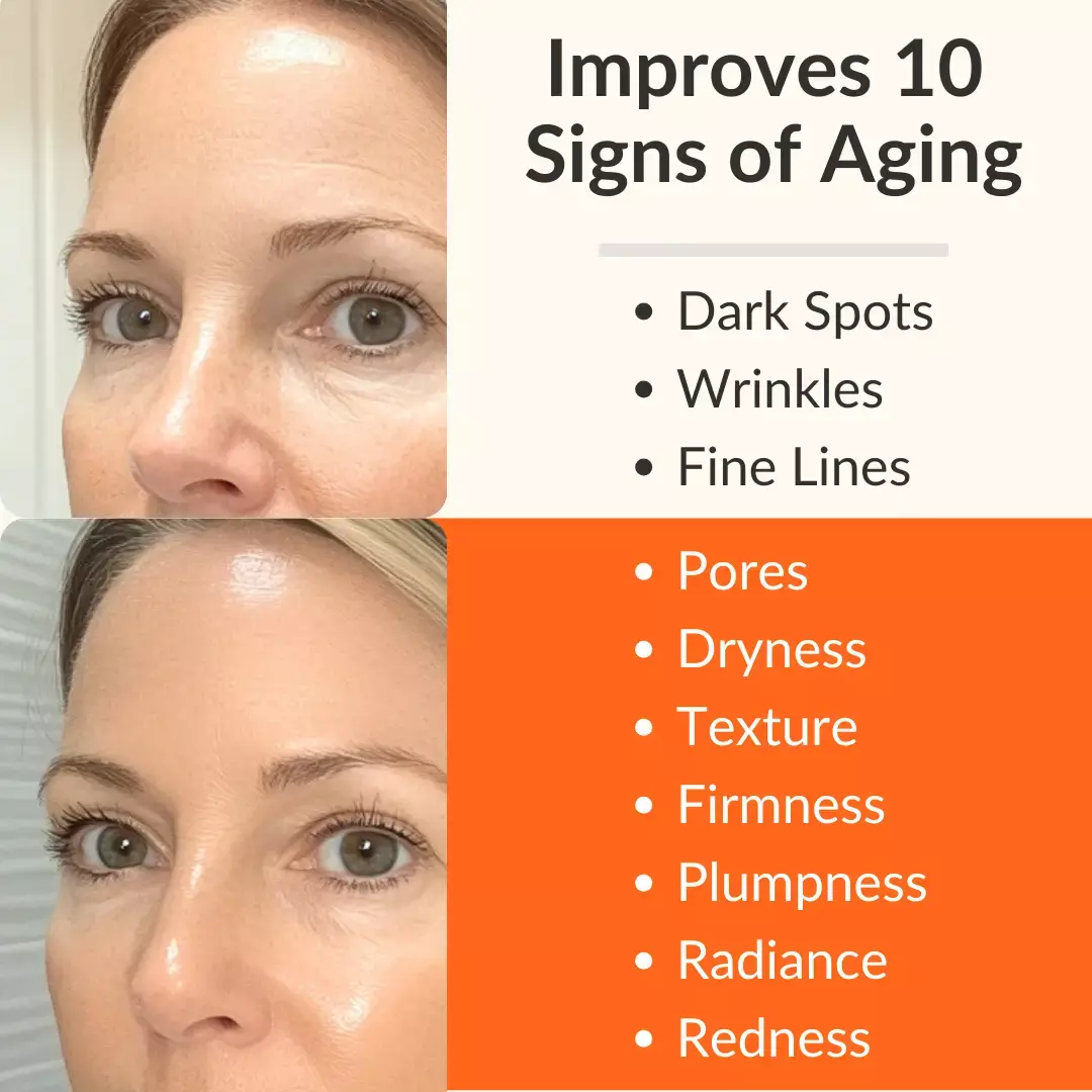 Levaye vitamin c serum