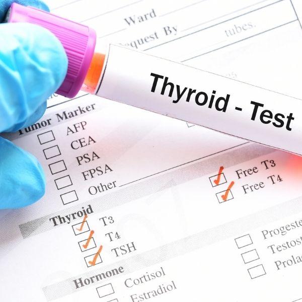 test thyroïde