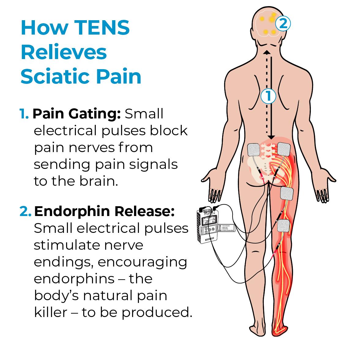 TENS Unit and Sciatica Pain Relief TENS 7000