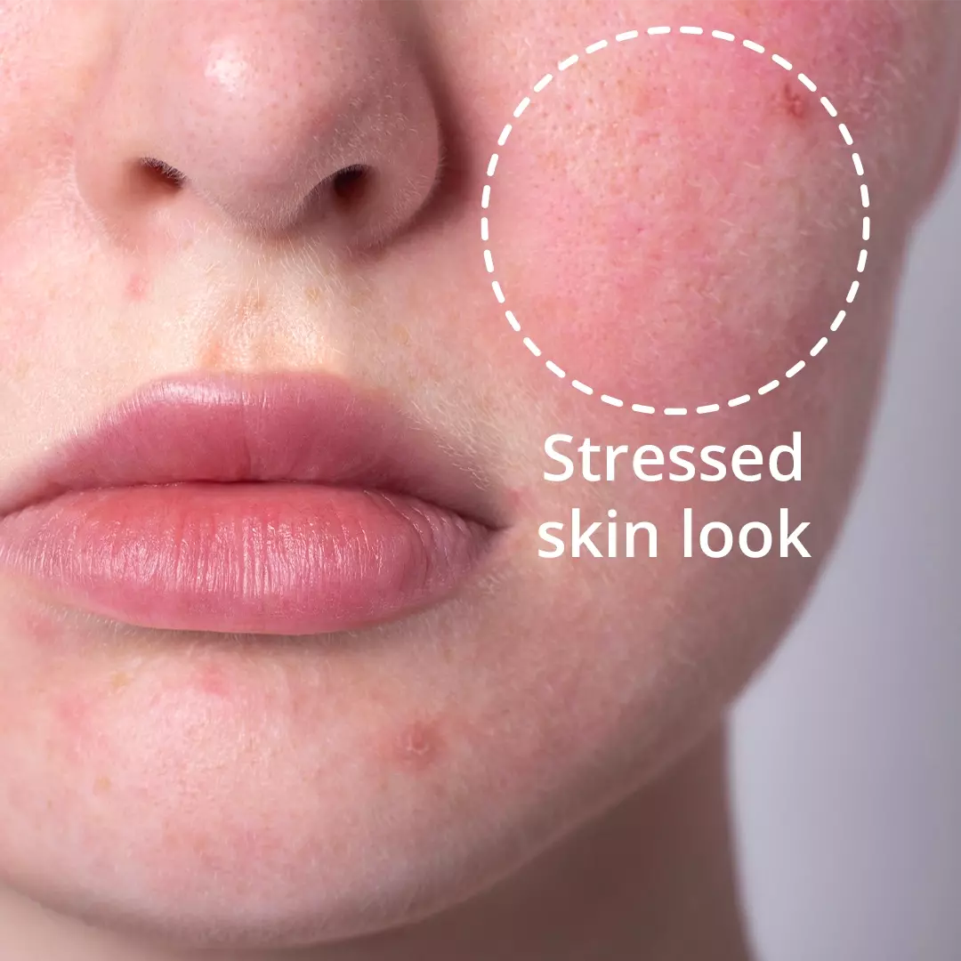 stressed skin look