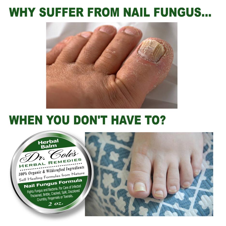 Dr. Cole's Nail Fungus Balm