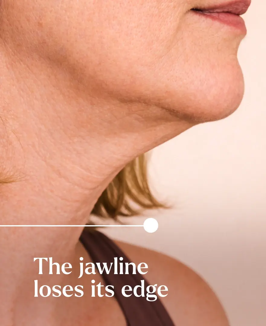 Women showing jawline loses its edge