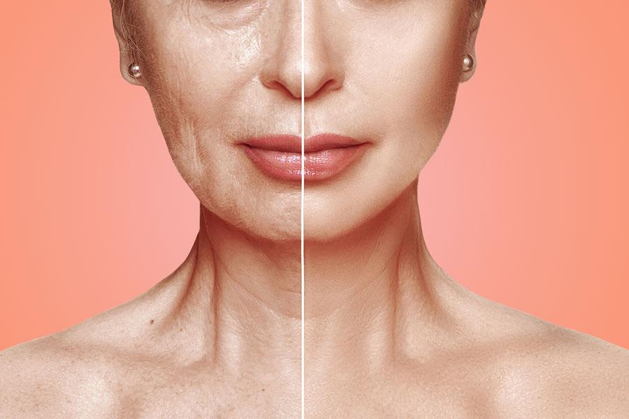 Young versus old skin